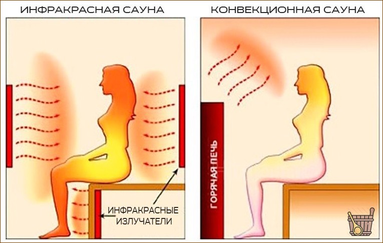 Инфракрасная сауна: преимущества и особенности процедуры